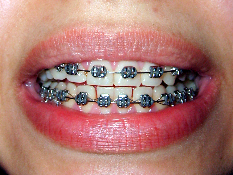 images/ortodonta.jpgcc015.jpg